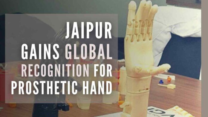 The start-up created for the prosthetic hand two years back is now worth crores of rupees and is attracting laurels globally