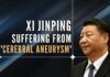 Chinese President Xi Jinping is reportedly suffering from a cerebral aneurysm, which can be critical in some cases