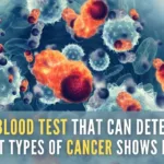 The trial conducted by the UK National Health Service showed that the test correctly revealed two out of every three cancers among 5,000 people