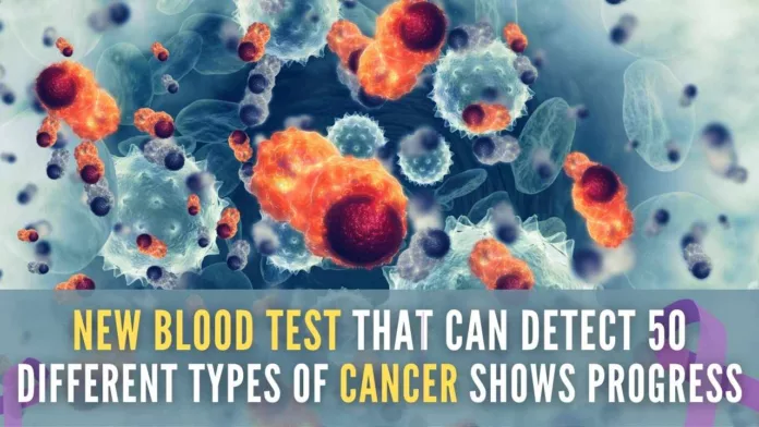 The trial conducted by the UK National Health Service showed that the test correctly revealed two out of every three cancers among 5,000 people